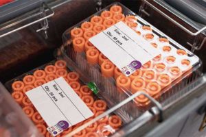 diagnostic samples shipment monitoring