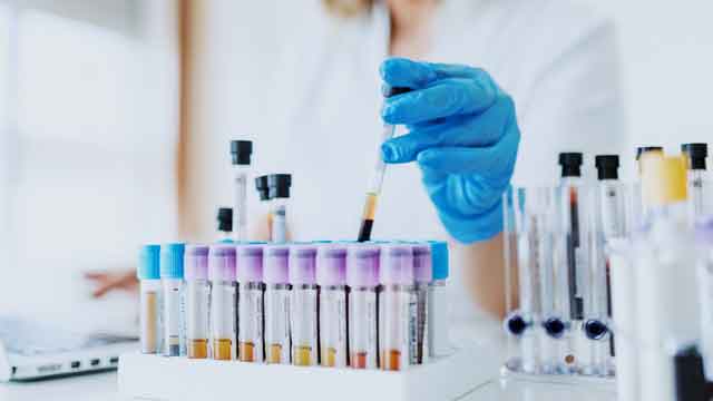 diagnostic sample shipping temperature, healthcare temperature indicator, diagnostic test temperature monitoring