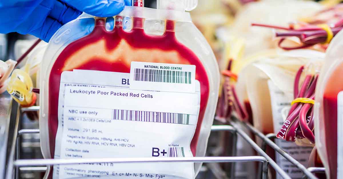 Red Blood Cell Leukocyte-reduced red blood cells temperature storage